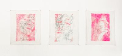 traces in stitches on my face